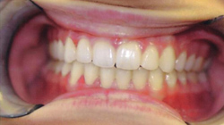 Orthodontic Specialists After