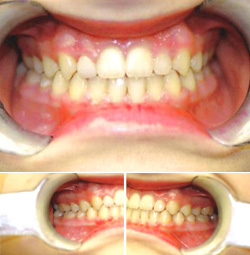 Orthodontic Specialists After